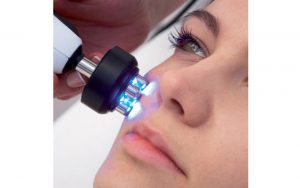 How Radio Frequency Can Help With Saggy Skin While Producing New Collagen