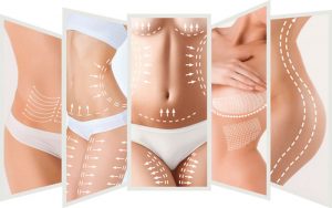 9 BENEFITS OF ULTRASOUND FAT CAVITATION THERAPY
