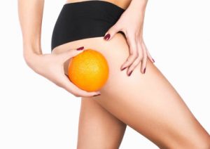 Cellulite? What really works?